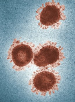 Coronavirus1.jpg